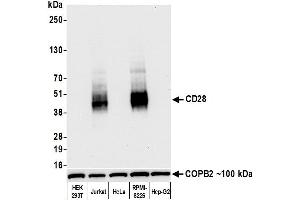 Western Blotting (WB) image for anti-CD28 (CD28) (AA 170-220) antibody (ABIN7455122) (Recombinant CD28 抗体  (AA 170-220))