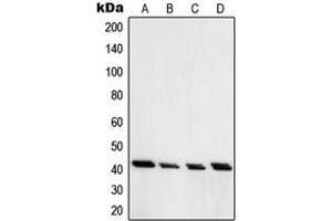 Western Blotting (WB) image for anti-Protein Kinase, CAMP-Dependent, Regulatory, Type I, alpha (Tissue Specific Extinguisher 1) (PRKAR1A) (C-Term) antibody (ABIN7296678)