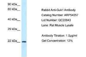 Western Blotting (WB) image for anti-Guanylate Kinase 1 (GUK1) (N-Term) antibody (ABIN2785668)