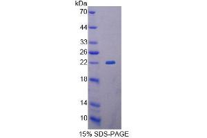 SDS-PAGE analysis of Human GCDH Protein.