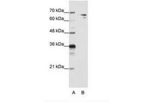 Image no. 2 for anti-Splicing Factor 1 (SF1) (N-Term) antibody (ABIN203234) (Splicing Factor 1 抗体  (N-Term))