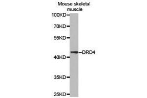 Western Blotting (WB) image for anti-Dopamine Receptor D4 (DRD4) antibody (ABIN1872359) (DRD4 抗体)