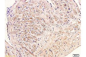 Immunohistochemistry (IHC) image for anti-Collagen, Type III (COL3) (AA 1301-1400) antibody (ABIN669981)