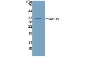 Detection of Recombinant calretinin, Human using Polyclonal Antibody to Calretinin (CR) (Calretinin 抗体  (AA 28-248))