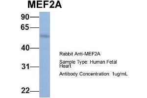 Host: Rabbit Target Name: MEF2A Sample Type: Human Fetal Heart Antibody Dilution: 1. (MEF2A 抗体  (N-Term))
