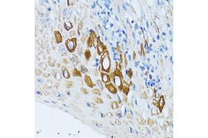 Immunohistochemistry of paraffin-embedded human esophagus using PSRC1 antibody (ABIN5973194) at dilution of 1/100 (40x lens). (PSRC1 抗体)
