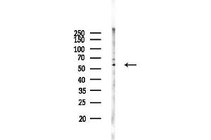 anti-Protein Phosphatase 2, Regulatory Subunit B' alpha (PPP2R5A) (Internal Region) antibody