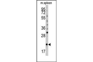 Image no. 1 for anti-BH3 Interacting Domain Death Agonist (BID) (pSer61) antibody (ABIN356817) (BID 抗体  (pSer61))