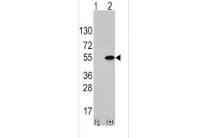 Western blot analysis of ATF4 (arrow) using rabbit anti-ATF4 Antibody  (ABIN390250 and ABIN2850543). (ATF4 抗体  (AA 220-252))