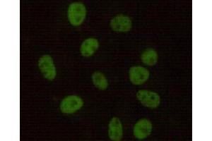 Immunocytochemistry stain of Hela using DNA-PKcs mouse mAb (1:100). (PRKDC 抗体)