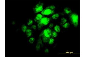 Immunofluorescence of monoclonal antibody to IRF5 on A-431 cell. (IRF5 抗体  (AA 395-504))
