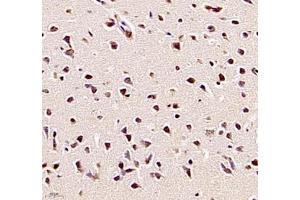 Immunohistochemistry of paraffin embedded mouse brain using TYW1B (ABIN7076025) at dilution of 1: 700 (400x lens)