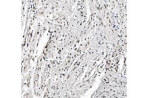 IHC analysis of FOXK1 using anti-FOXK1 antibody (ABIN7600295).
