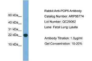 WB Suggested Anti-POP5  Antibody Titration: 0.