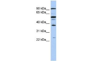 WB Suggested Anti-EZH1 Antibody Titration:  0. (EZH1 抗体  (N-Term))