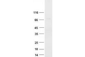 Western Blotting (WB) image for Nuclear Receptor Coactivator 4 (NCOA4) (Transcript Variant 5) protein (Myc-DYKDDDDK Tag) (ABIN2726904)