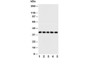 Western blot testing of FosB antibody and Lane 1:  HT1080;  2: SW620;  3: HeLa;  4: SMMC-7721;  5: MM453 cell lysate (FOSB 抗体  (N-Term))