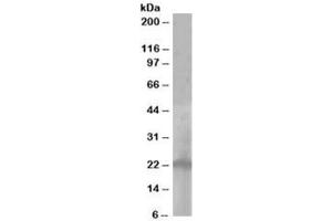 Western blot testing of A431 lysate with PALLID antibody at 1ug/ml. (Pallidin 抗体)