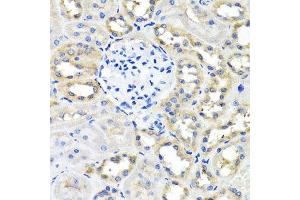 Immunohistochemistry (Paraffin-embedded Sections) (IHC (p)) image for anti-Secretogranin III (SCG3) (AA 199-468) antibody (ABIN6147425)