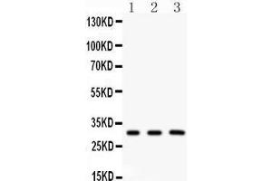 Western Blotting (WB) image for anti-Peroxiredoxin 4 (PRDX4) (AA 178-2081), (C-Term) antibody (ABIN3043905) (Peroxiredoxin 4 抗体  (C-Term))