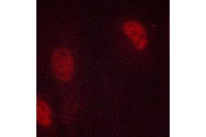 ABIN6267039 staining MCF-7 cells by ICC/IF. (Histone 3 抗体)