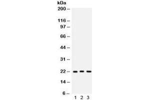 Western blot testing of 1) human A549, 2) rat brain and 3) mouse brain lysate with Peroxiredoxin 5 antibody. (Peroxiredoxin 5 抗体  (AA 66-198))