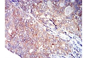 Immunohistochemistry (IHC) image for anti-Tumor Necrosis Factor Receptor Superfamily, Member 4 (TNFRSF4) (AA 29-214) antibody (ABIN5611187)
