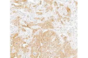 anti-phosphoglycerate Dehydrogenase (PHGDH) (AA 1-50) antibody