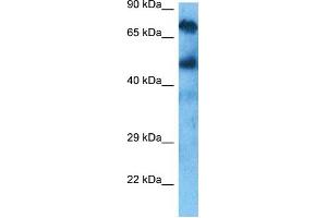 Host:  Rabbit  Target Name:  KCND3  Sample Tissue:  Liver Tumor lysates  Antibody Dilution:  1ug/ml (KCND3 抗体  (C-Term))
