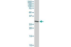 Western Blotting (WB) image for anti-Actin Related Protein 2/3 Complex, Subunit 2, 34kDa (ARPC2) (AA 1-300) antibody (ABIN564373)