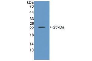 Western blot analysis of recombinant Mouse CA9. (CA9 抗体  (AA 88-280))