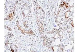 Immunohistochemistry (IHC) image for anti-Stress-Induced-phosphoprotein 1 (STIP1) antibody (ABIN2855549)