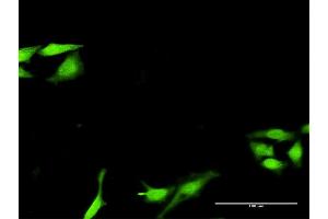 Immunofluorescence of purified MaxPab antibody to SNF8 on HeLa cell. (SNF8 抗体  (AA 1-258))