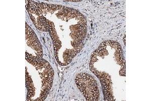 Immunohistochemical staining of human prostate with KIAA0256 polyclonal antibody  shows strong cytoplasmic positivity in glandular cells. (SECISBP2L 抗体)