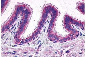 Immunohistochemistry (IHC) image for anti-Prostaglandin E Receptor 2 (Subtype EP2), 53kDa (PTGER2) (Extracellular Domain) antibody (ABIN1048569)