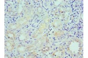 Immunohistochemistry of paraffin-embedded human kidney tissue using ABIN7158577 at dilution of 1:100 (LRP6 抗体  (AA 20-150))