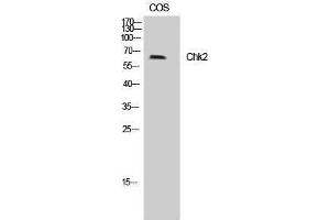 Western Blotting (WB) image for anti-Checkpoint Kinase 2 (CHEK2) (Tyr599) antibody (ABIN3183906) (CHEK2 抗体  (Tyr599))