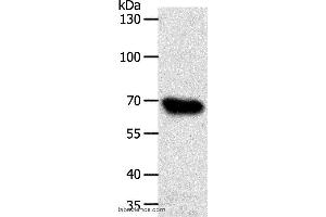 Western blot analysis of HT-29 cell, using ABCG1 Polyclonal Antibody at dilution of 1:500 (ABCG1 抗体)