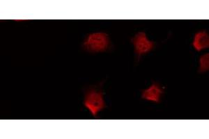 ABIN6266840 staining Hela by IF/ICC. (FKRP 抗体  (N-Term))