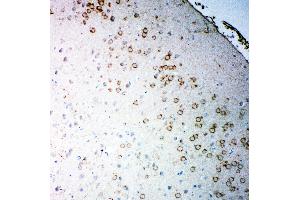 Anti-Muscarinic Acetylcholine Receptor 2 antibody,  IHC(P) IHC(P): Rat Brain Tissue (Muscarinic Acetylcholine Receptor M2 抗体  (C-Term))