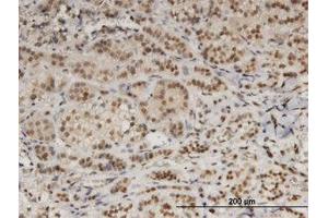 Image no. 1 for anti-Damage Specific DNA Binding Protein 1 (DDB1) (AA 1044-1141) antibody (ABIN599367) (DDB1 抗体  (AA 1044-1141))