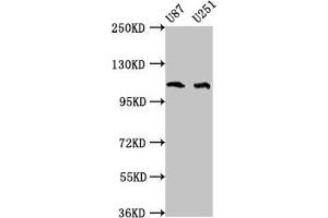 Western Blot Positive WB detected in: U87 whole cell lysate, U251 whole cell lysate All lanes: ABL2 antibody at 4 μg/mL Secondary Goat polyclonal to rabbit IgG at 1/50000 dilution Predicted band size: 129, 125, 127, 115, 118, 116, 117, 61 kDa Observed band size: 115 kDa (ABL2 抗体  (AA 862-1064))