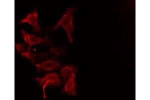 ABIN6275868 staining HuvEc cells by IF/ICC. (CD90 抗体  (Internal Region))