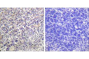 Peptide - +Immunohistochemistry analysis of paraffin-embedded human thyroid gland tissue using HBP1 antibody. (HBP1 抗体)