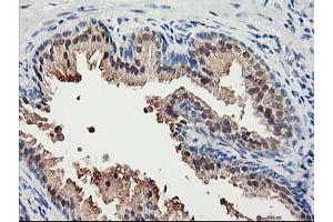 Immunohistochemical staining of paraffin-embedded Human prostate tissue using anti-ACSS2 mouse monoclonal antibody. (ACSS2 抗体)