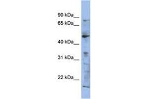 Image no. 1 for anti-RAB3A Interacting Protein (Rabin3) (RAB3IP) (AA 107-156) antibody (ABIN6743739) (RAB3IP 抗体  (AA 107-156))