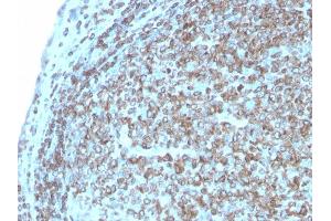 Formalin-fixed, paraffin-embedded human Tonsil stained with CD74 Recombinant Rabbit Monoclonal Antibody (CLIP/3127R). (Recombinant CD74 抗体)