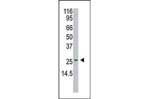 Western Blotting (WB) image for anti-Anterior Pharynx Defective 1 Homolog A (C. Elegans) (APH1A) (AA 77-109), (N-Term) antibody (ABIN390272)