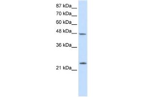 WB Suggested Anti-CBX6 Antibody Titration:  2. (CBX6 抗体  (N-Term))