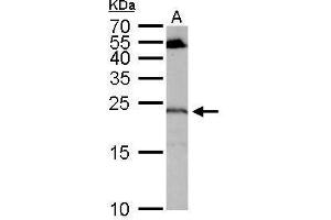 WB Image RGS4 antibody detects RGS4 protein by Western blot analysis. (RGS4 抗体)